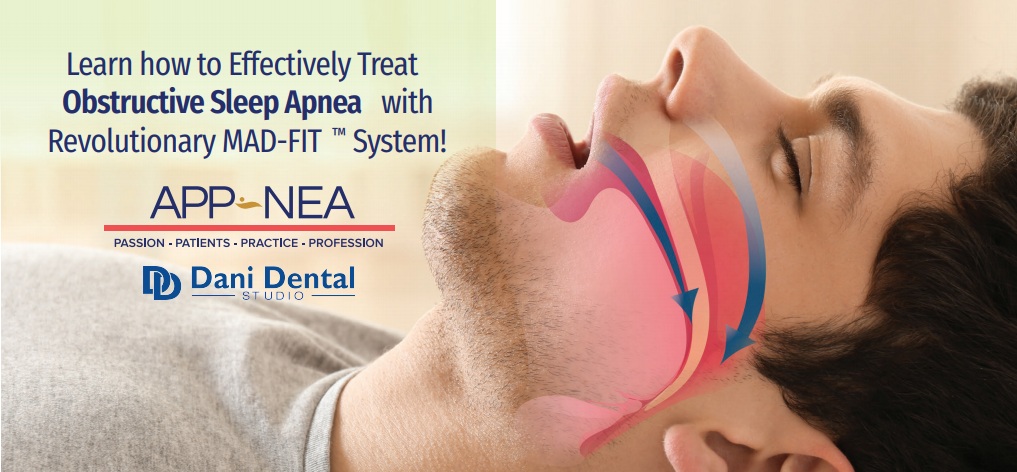 Obstructive Sleep Apnea